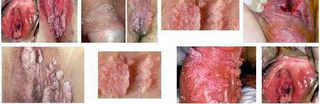 Illustration for article titled Apa Merek Obat Penyakit Jengger Ayam Dari Denature